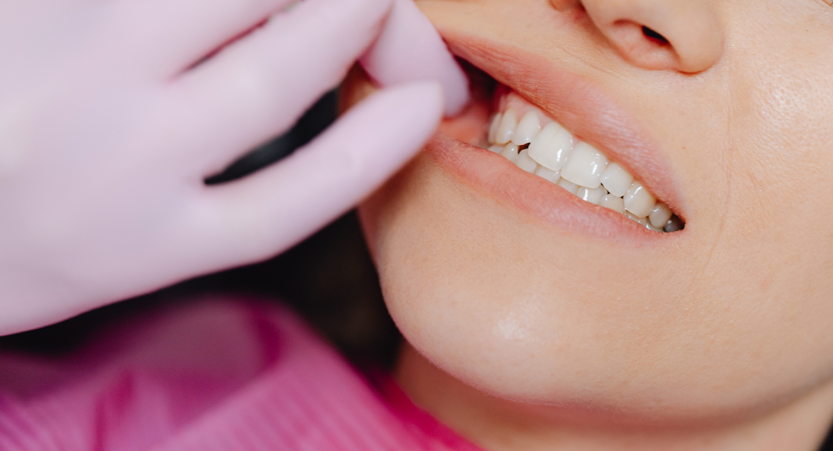 セラミック治療が選ばれる理由